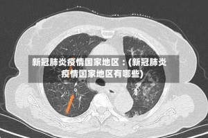新冠肺炎疫情国家地区︰(新冠肺炎疫情国家地区有哪些)
